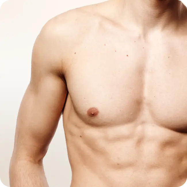 Gynecomastia Surgery